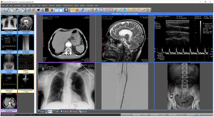 Sante DICOM Viewer Pro 14.2.7