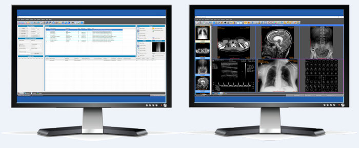 Sante PACS Server PG 4.3.1 + Sante PACS Server 4.3.1